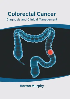 Cancer colorectal : Diagnostic et gestion clinique - Colorectal Cancer: Diagnosis and Clinical Management