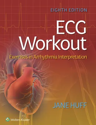 Séance d'entraînement ECG : Exercices d'interprétation de l'arythmie - ECG Workout: Exercises in Arrhythmia Interpretation