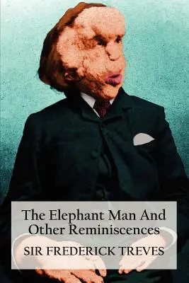 Elephant Man et autres réminiscences - The Elephant Man and Other Reminiscences