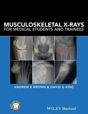 Radiographies de l'appareil locomoteur pour les étudiants et les stagiaires en médecine - Musculoskeletal X-Rays for Medical Students and Trainees