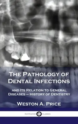 Pathologie des infections dentaires : et ses rapports avec les maladies générales - Histoire de l'odontologie - Pathology of Dental Infections: and Its Relation to General Diseases - History of Dentistry