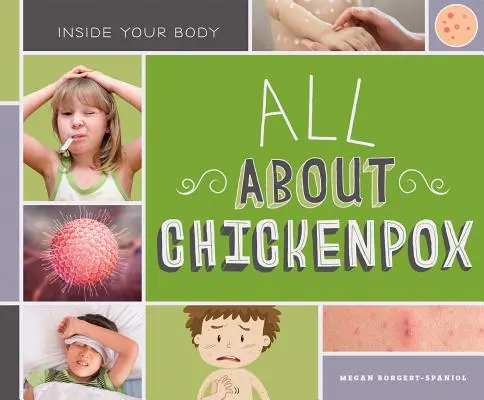 Tout sur la varicelle - All about Chickenpox