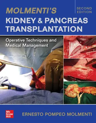 La transplantation rénale et pancréatique de Molmenti : Techniques opératoires et prise en charge médicale - Molmenti's Kidney and Pancreas Transplantation: Operative Techniques and Medical Management