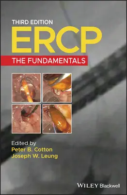 Ercp : Les fondamentaux - Ercp: The Fundamentals