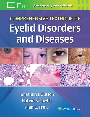 Comprehensive Textbook of Eyelid Disorders and Diseases (Manuel complet des troubles et maladies des paupières) - Comprehensive Textbook of Eyelid Disorders and Diseases