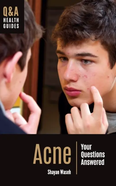 Acné : les réponses à vos questions - Acne: Your Questions Answered