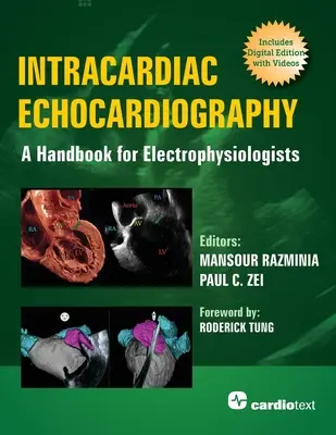 Echocardiographie intracardiaque : Un manuel pour les électrophysiologistes - Intracardiac Echocardiography: A Handbook for Electrophysiologists