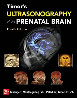L'échographie du cerveau prénatal de Timor, quatrième édition - Timor's Ultrasonography of the Prenatal Brain, Fourth Edition