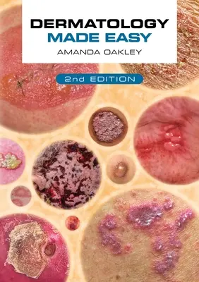 Dermatologie facile, deuxième édition - Dermatology Made Easy, Second Edition