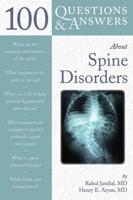 100 questions et réponses sur les troubles de la colonne vertébrale - 100 Q&as about Spine Disorders