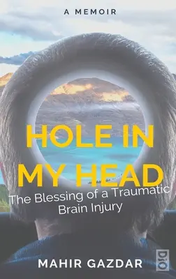 Un trou dans la tête : la bénédiction d'une lésion cérébrale traumatique - Hole in My Head: The Blessing of a Traumatic Brain Injury