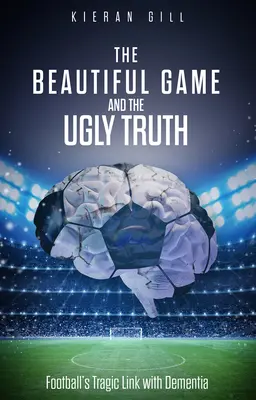 Le beau jeu et l'affreuse vérité : le lien tragique entre le football et la démence - The Beautiful Game and the Ugly Truth: Football's Tragic Link with Dementia
