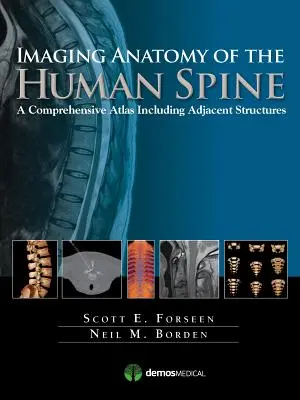 Anatomie par imagerie de la colonne vertébrale humaine : Un atlas complet incluant les structures adjacentes - Imaging Anatomy of the Human Spine: A Comprehensive Atlas Including Adjacent Structures