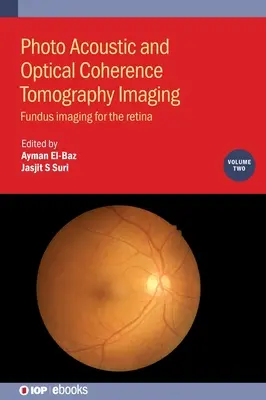 Imagerie par tomographie en cohérence optique et photo-acoustique, Volume 2 - Photo Acoustic and Optical Coherence Tomography Imaging, Volume 2