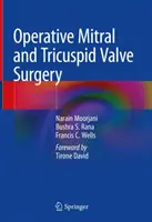 Chirurgie opératoire des valves mitrales et tricuspides - Operative Mitral and Tricuspid Valve Surgery