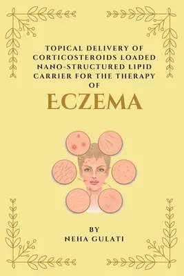 Délivrance topique d'un vecteur lipidique nanostructuré chargé de corticostéroïdes pour la thérapie de l'eczéma - Topical Delivery of Corticosteroids Loaded Nanostructured Lipid Carrier for the Therapy of Eczema