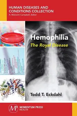 L'hémophilie : La maladie royale - Hemophilia: The Royal Disease