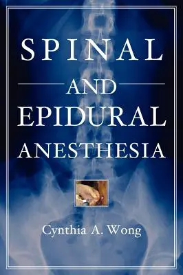 Anesthésie spinale et péridurale - Spinal and Epidural Anesthesia