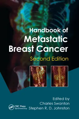 Manuel du cancer du sein métastatique - Handbook of Metastatic Breast Cancer