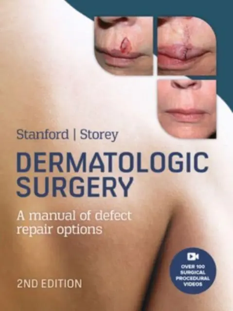 Chirurgie dermatologique - Dermatologic Surgery