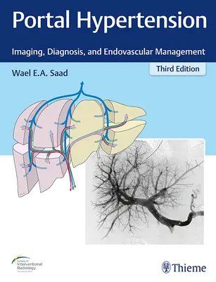 Hypertension portale : Imagerie, diagnostic et traitement endovasculaire - Portal Hypertension: Imaging, Diagnosis, and Endovascular Management