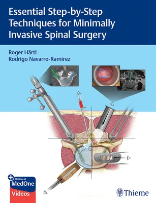 Techniques essentielles, étape par étape, pour la chirurgie spinale mini-invasive - Essential Step-By-Step Techniques for Minimally Invasive Spinal Surgery