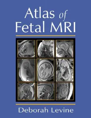 Atlas de l'IRM fœtale - Atlas of Fetal MRI