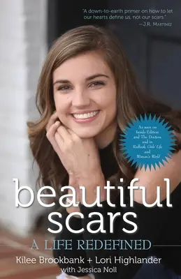 De belles cicatrices : Une vie redéfinie - Beautiful Scars: A Life Redefined