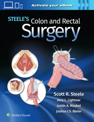 Chirurgie du côlon et du rectum de Steele - Steele's Colon and Rectal Surgery