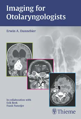 L'imagerie pour les oto-rhino-laryngologistes - Imaging for Otolaryngologists