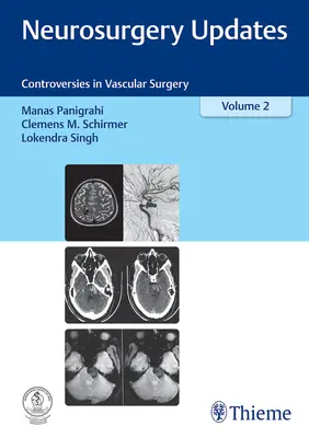 Neurosurgery Updates, Vol. 2 : Controversies in Vascular Surgery (en anglais) - Neurosurgery Updates, Vol. 2: Controversies in Vascular Surgery