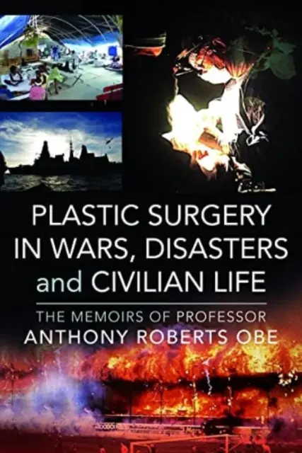La chirurgie plastique dans les guerres, les catastrophes et la vie civile : Les mémoires du professeur Anthony Roberts OBE - Plastic Surgery in Wars, Disasters and Civilian Life: The Memoirs of Professor Anthony Roberts OBE