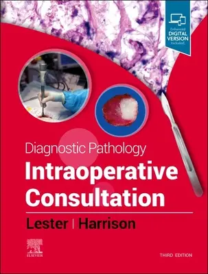 Pathologie diagnostique : Consultation peropératoire - Diagnostic Pathology: Intraoperative Consultation