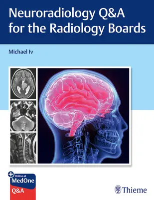 Questions et réponses sur la neuroradiologie pour les examens de radiologie - Neuroradiology Q&A for the Radiology Boards