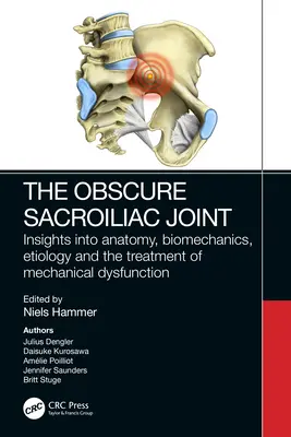 L'obscure articulation sacro-iliaque : aperçu de l'anatomie, de la biomécanique, de l'étiologie et du traitement du dysfonctionnement mécanique - The Obscure Sacroiliac Joint: Insights Into Anatomy, Biomechanics, Etiology and the Treatment of Mechanical Dysfunction