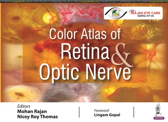 Atlas couleur de la rétine et du nerf optique - Color Atlas of Retina & Optic Nerve