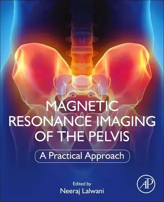 Imagerie par résonance magnétique du bassin : Une approche pratique - Magnetic Resonance Imaging of the Pelvis: A Practical Approach