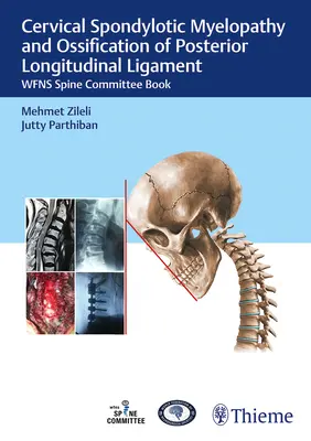 Myélopathie spondylotique cervicale et ossification du ligament longitudinal postérieur : Wfns Spine Committee Book - Cervical Spondylotic Myelopathy and Ossification of Posterior Longitudinal Ligament: Wfns Spine Committee Book