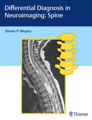 Diagnostic différentiel en neuro-imagerie : La colonne vertébrale - Differential Diagnosis in Neuroimaging: Spine