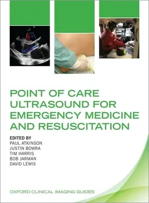 L'échographie au point d'intervention pour la médecine d'urgence et la réanimation - Point of Care Ultrasound for Emergency Medicine and Resuscitation