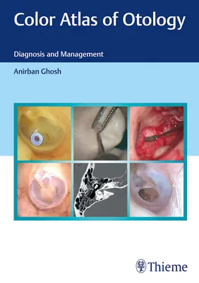 Atlas couleur d'otologie : Diagnostic et gestion - Color Atlas of Otology: Diagnosis and Management