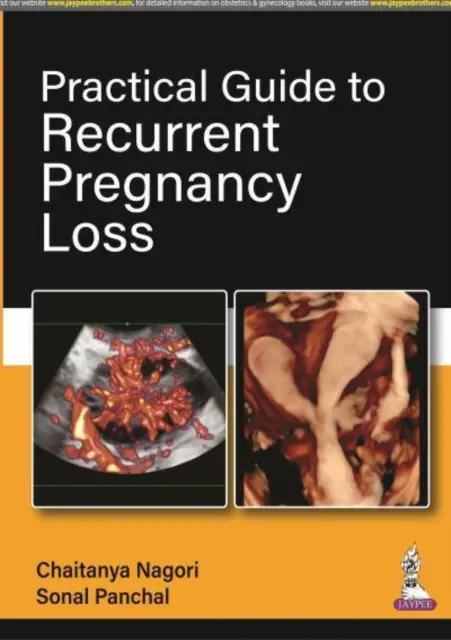 Guide pratique des pertes de grossesse récurrentes - Practical Guide to Recurrent Pregnancy Loss