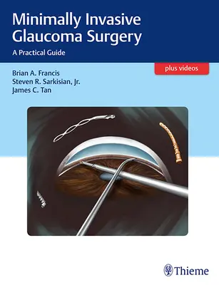 Chirurgie mini-invasive du glaucome : Un guide pratique - Minimally Invasive Glaucoma Surgery: A Practical Guide