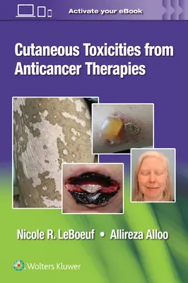 Réactions cutanées aux thérapies anticancéreuses - Cutaneous Reactions from Anti-Cancer Therapies
