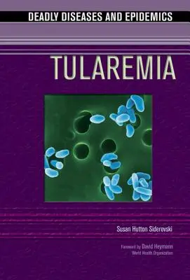 La tularémie - Tularemia