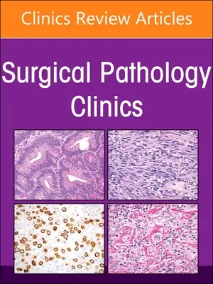 Pathologie endocrinienne, un numéro de Surgical Pathology Clinics : Volume 16-1 - Endocrine Pathology, an Issue of Surgical Pathology Clinics: Volume 16-1
