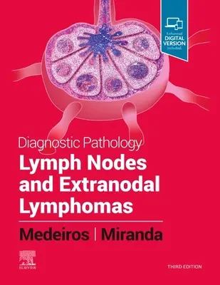 Pathologie diagnostique : Les ganglions lymphatiques et les lymphomes extranodaux - Diagnostic Pathology: Lymph Nodes and Extranodal Lymphomas