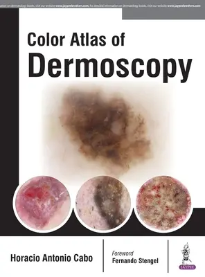 Atlas en couleur de la dermatoscopie - Color Atlas of Dermoscopy