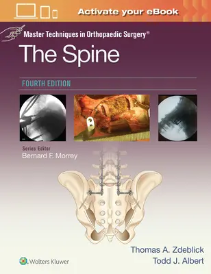 Techniques maîtresses en chirurgie orthopédique : La colonne vertébrale - Master Techniques in Orthopaedic Surgery: The Spine