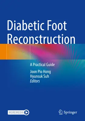 Reconstruction du pied diabétique : Un guide pratique - Diabetic Foot Reconstruction: A Practical Guide